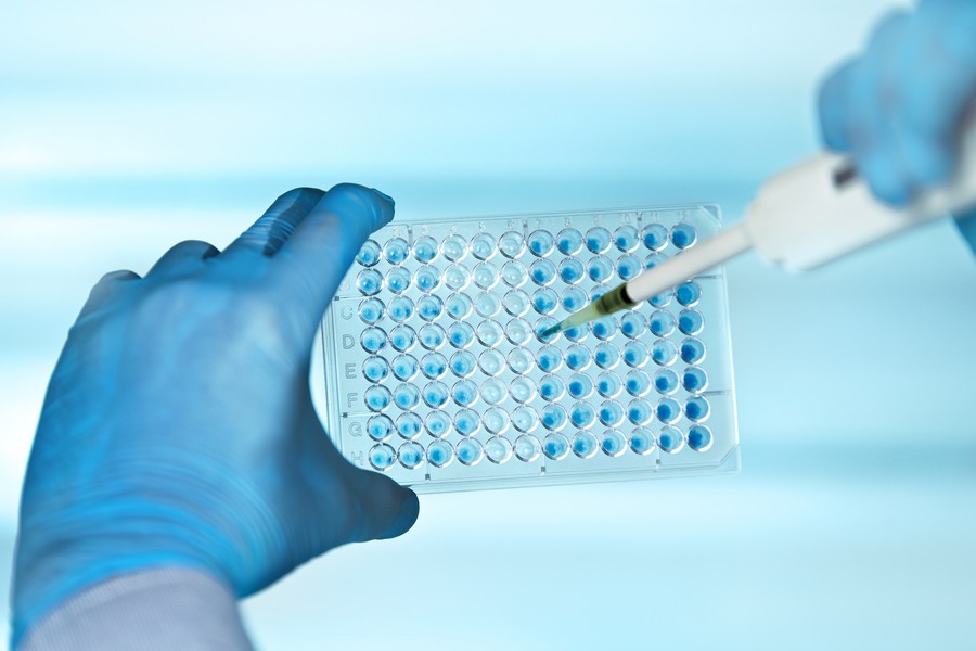 Biochemical assays for kinase screening and profiling