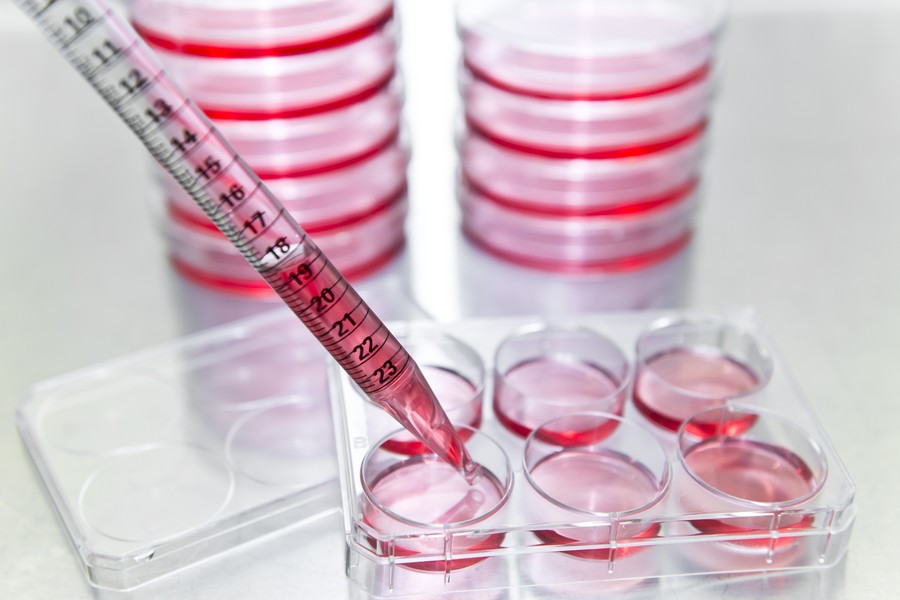 Cell-based assays for kinase screening and profiling