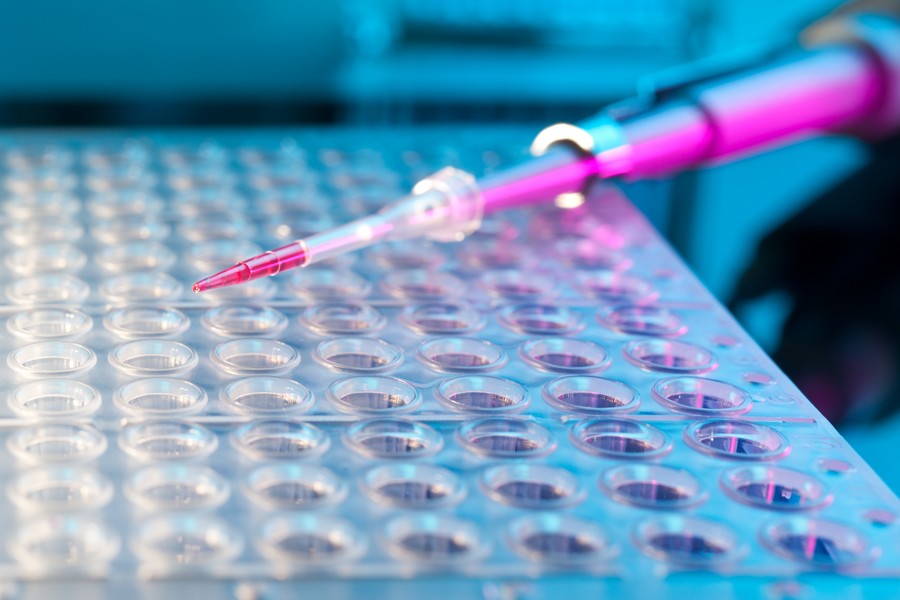 Specialized services for kinase screening and profiling