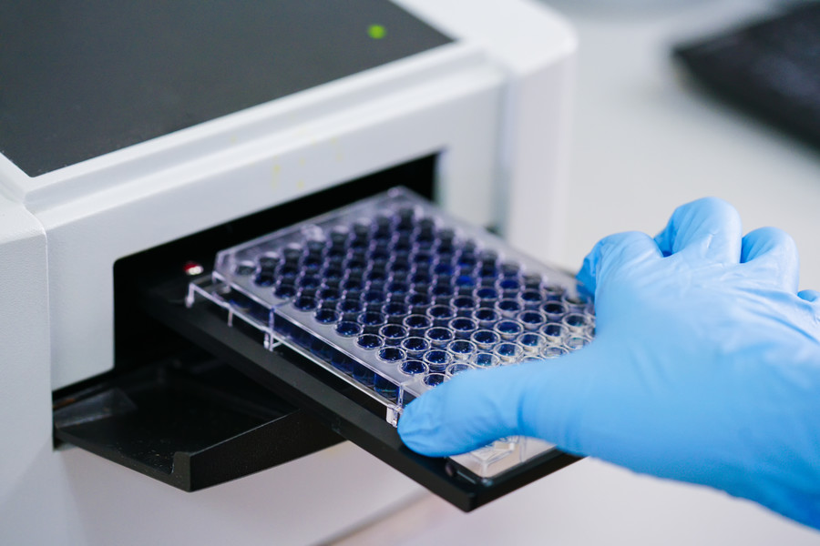 Custom enzyme assay development service at Creative Enzymes