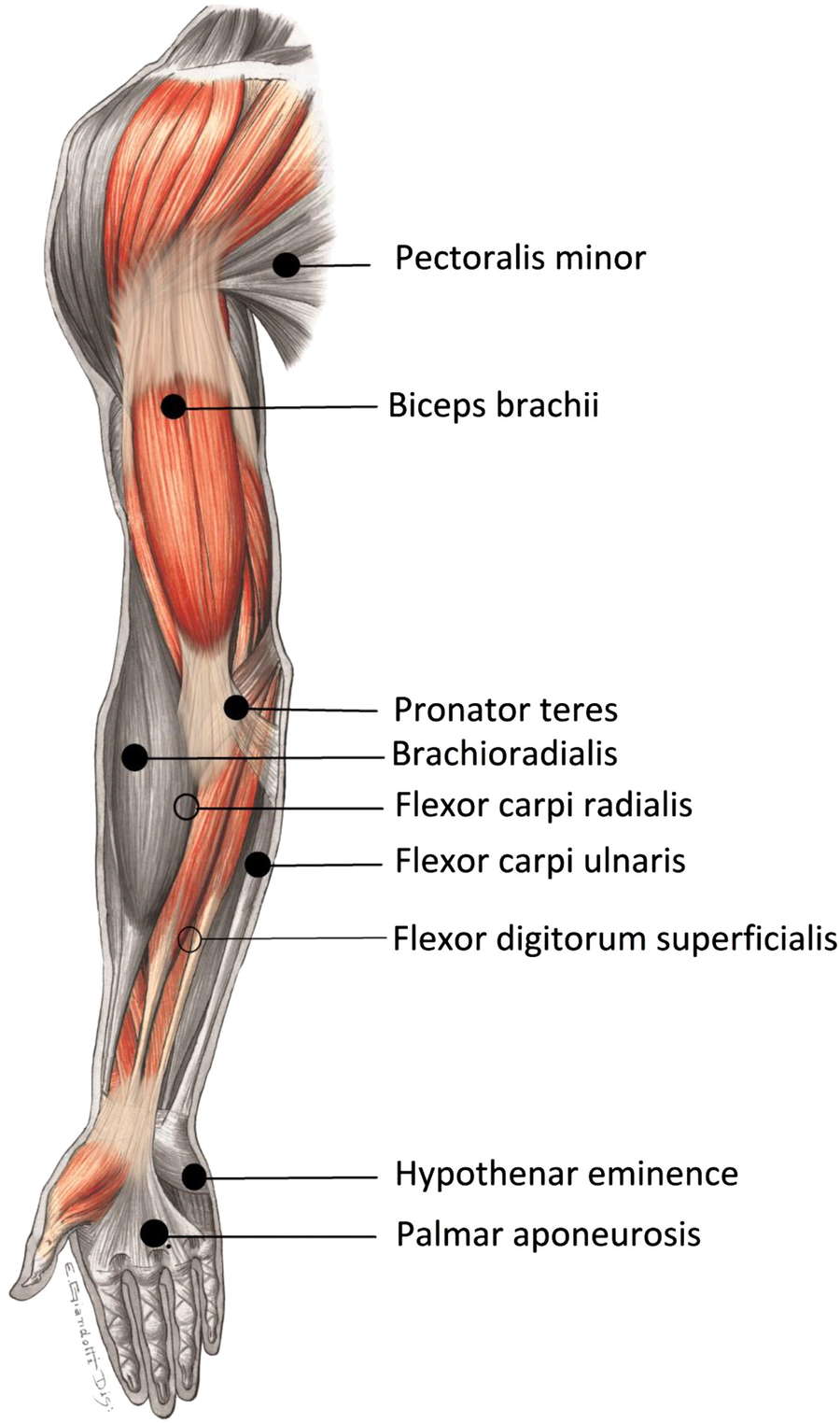 Human recombinant hyaluronidase injections for upper limb muscle stiffness in individuals with cerebral injury.