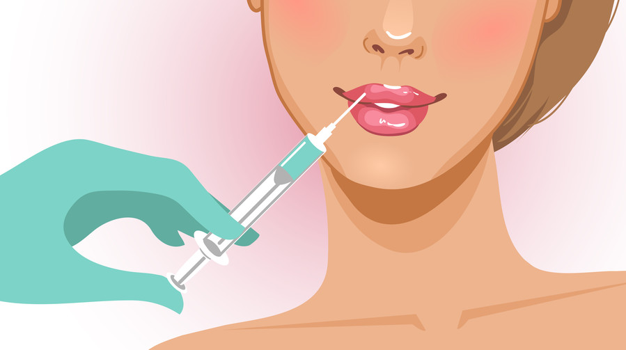 An illustration of lip filler.