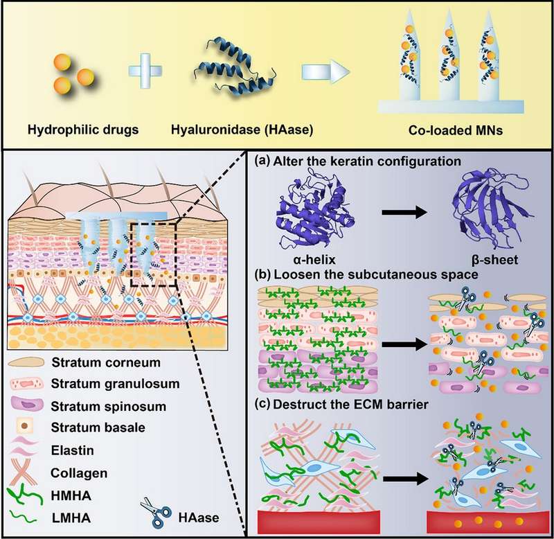 Mechanisms of hyaluronidase to enhance transdermal delivery efficiency: change the keratin configuration, loosen the subcutaneous space, and destroy the ECM barrier.