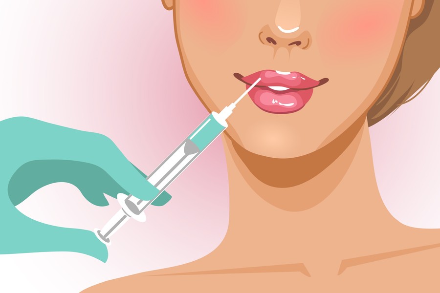 Dissolving Lip Fillers with Hyaluronidase: How Many Units Are Needed?