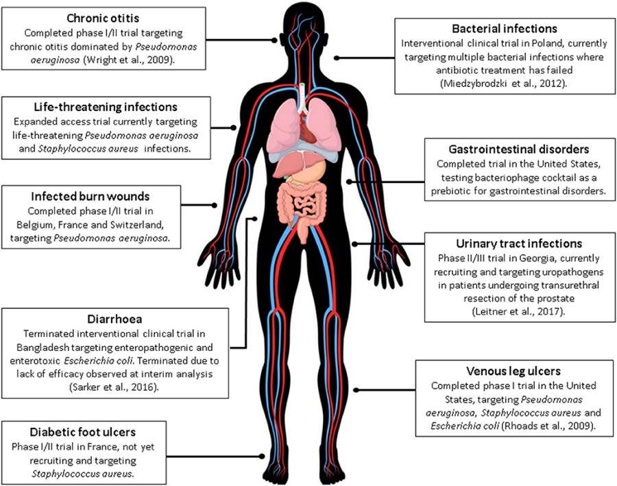Summary of human phage therapy trials, including chronic ear infections, bacterial infections, life-threatening infections, gastrointestinal disorders, and more.