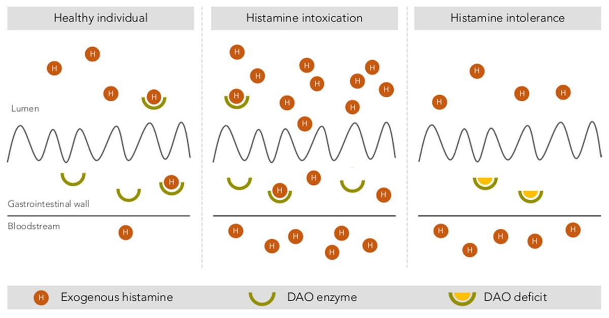 Intestinal degradation of histamine by the DAO enzyme in a healthy individual, in cases of histamine intoxication, and in cases of histamine intolerance.