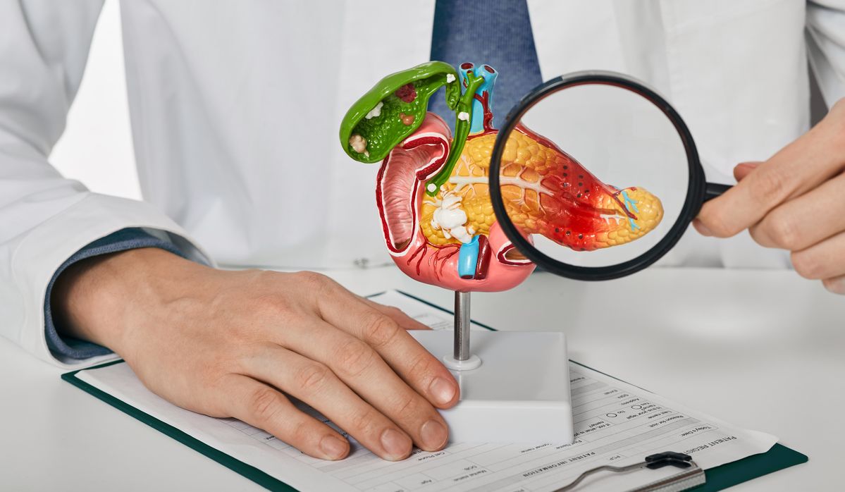 A pancreas model with pancreatitis.