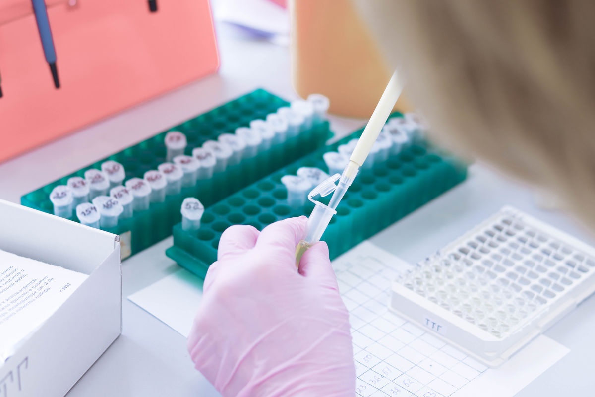Technical support and initial evaluation of substrates for identifying the optimal enzymatic reaction substrate