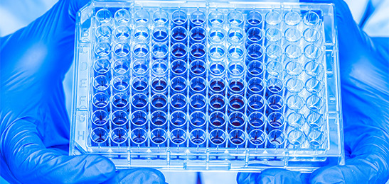 Creatinase/Creatininase/Sarcosine Oxidase