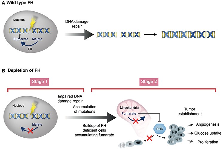 Two stage model of fumarase depletion leading to tumorigenesis