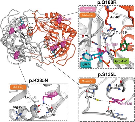 Structural basis of the most  common hGALT variants