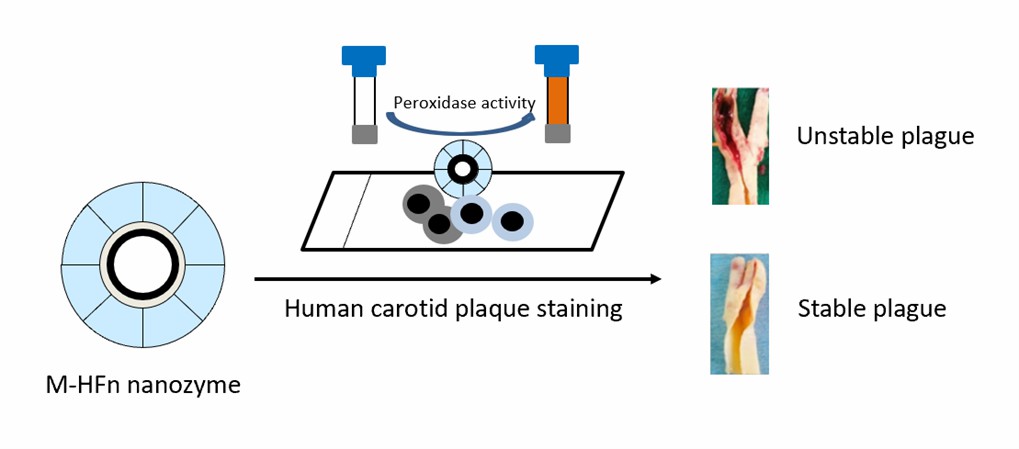 M-HFn nanozymes specifically stain the unstable plaques. - Creative Enzymes