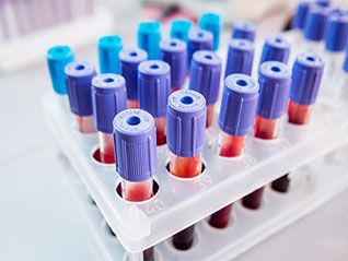 Featured Enzyme Products for Diagnostic Use