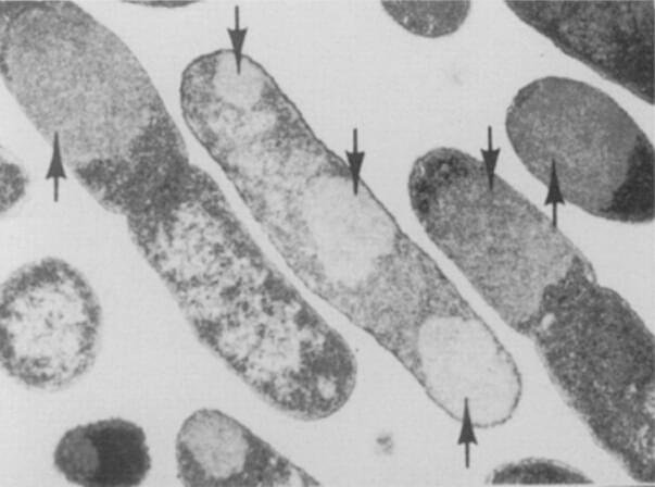 Solubilizing Inclusion Body