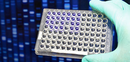 Screening of Enzyme Ligands